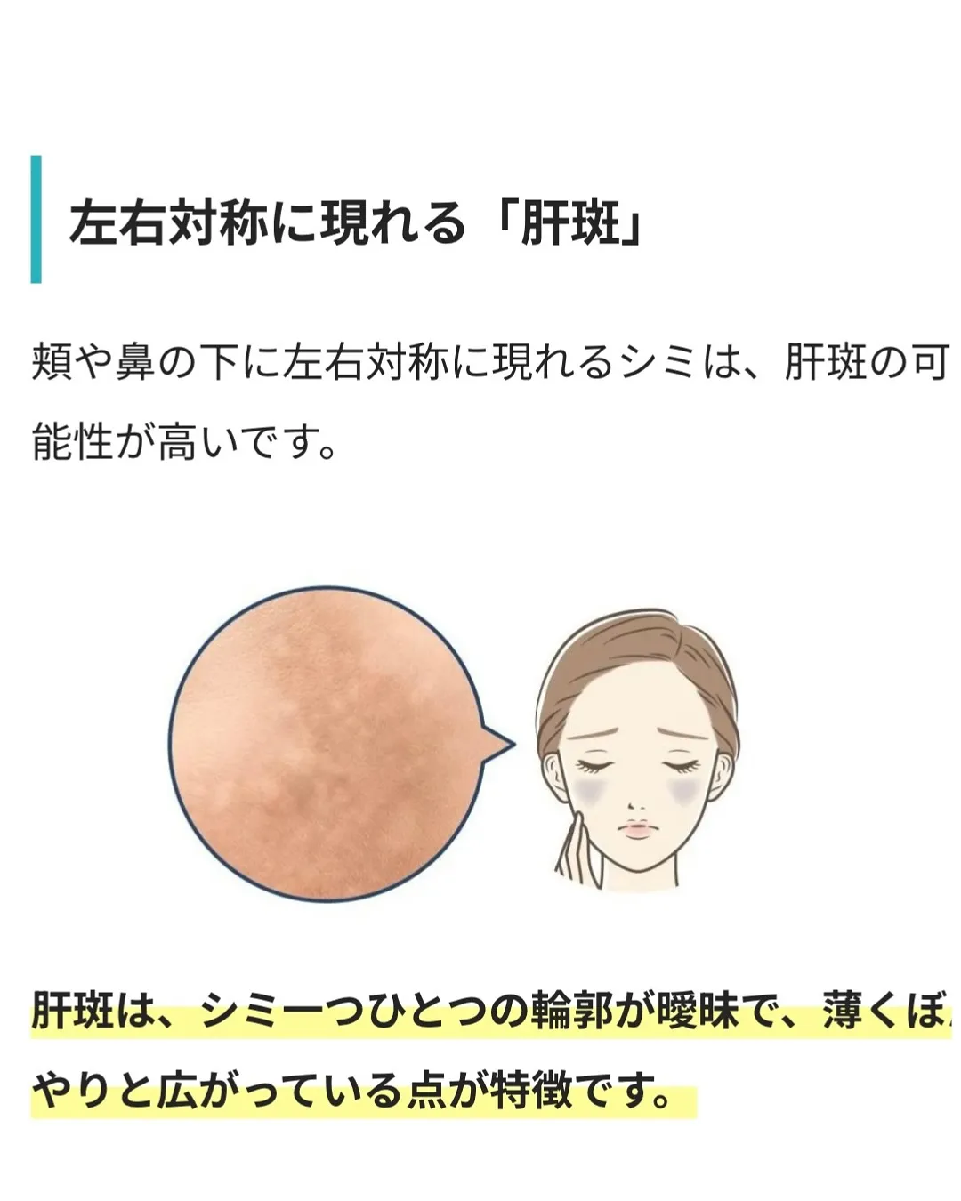 \老けて見える...年々濃くなるシミ/