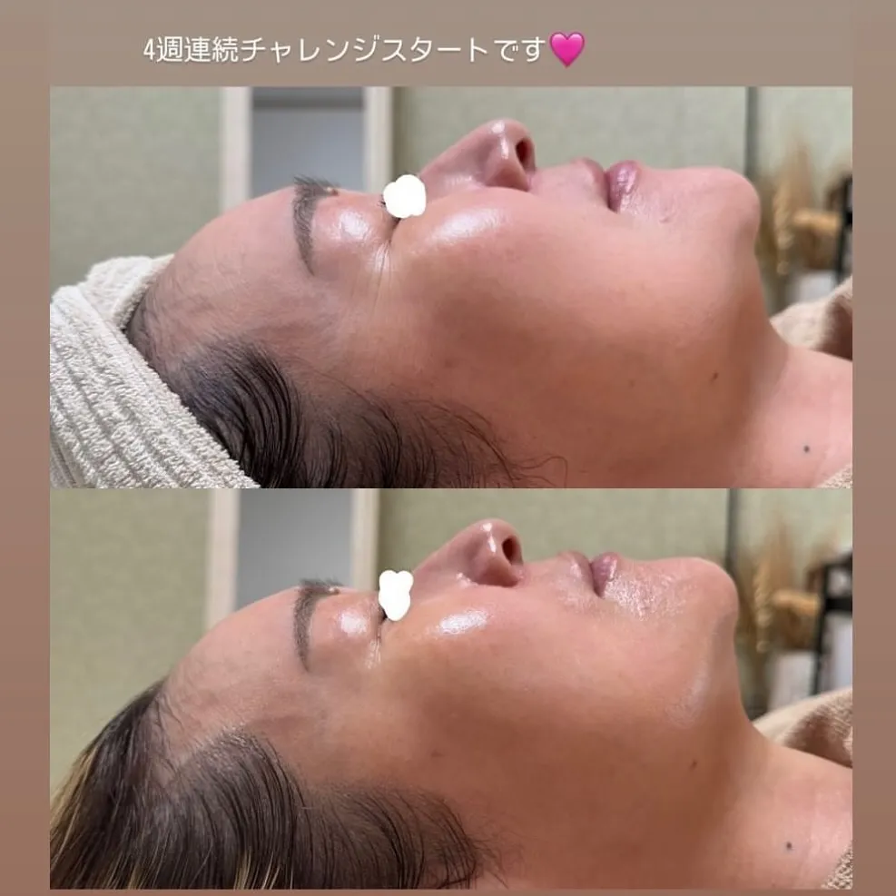 たるみ.しわ改善にもいい👍