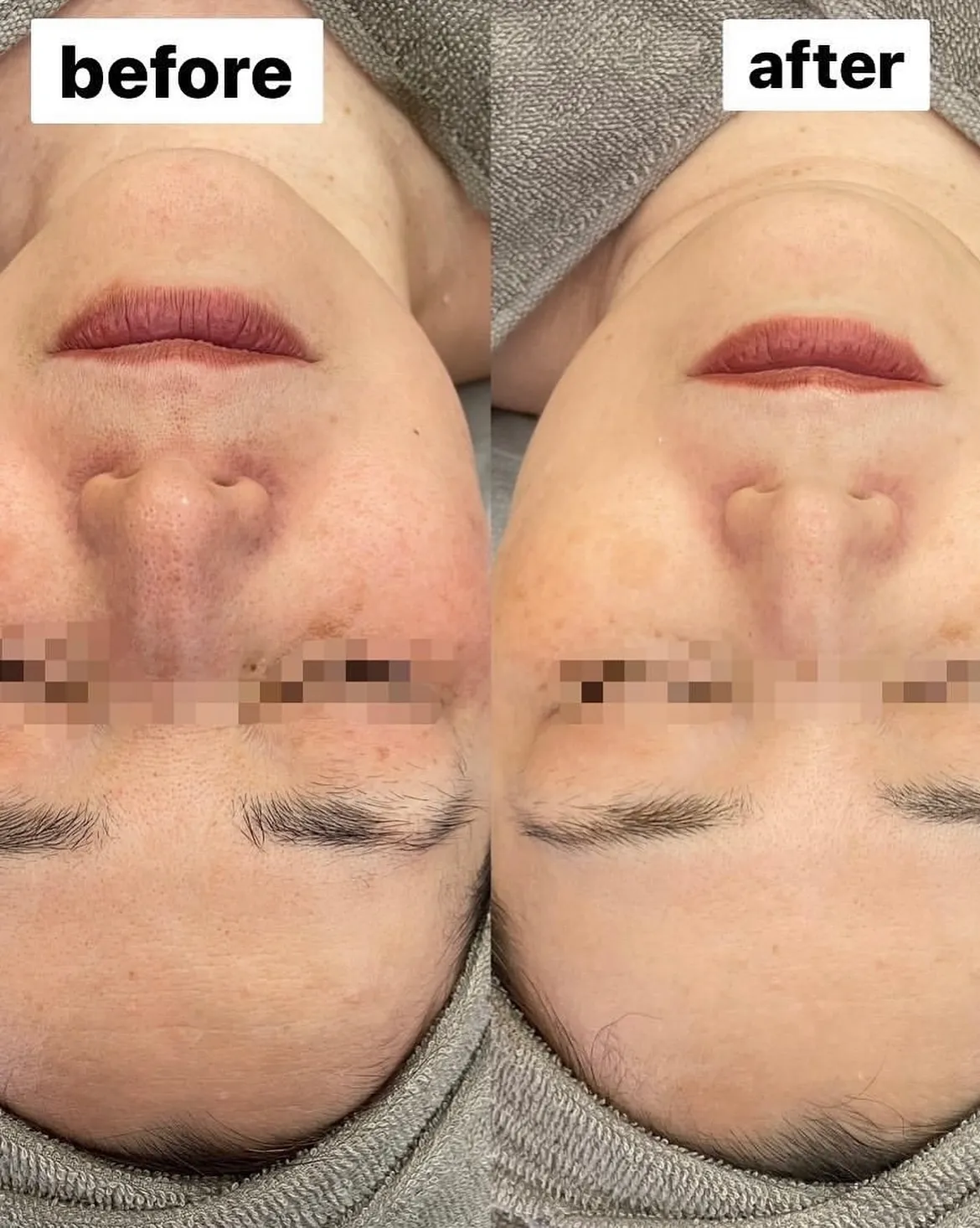 紫外線ケア☀️