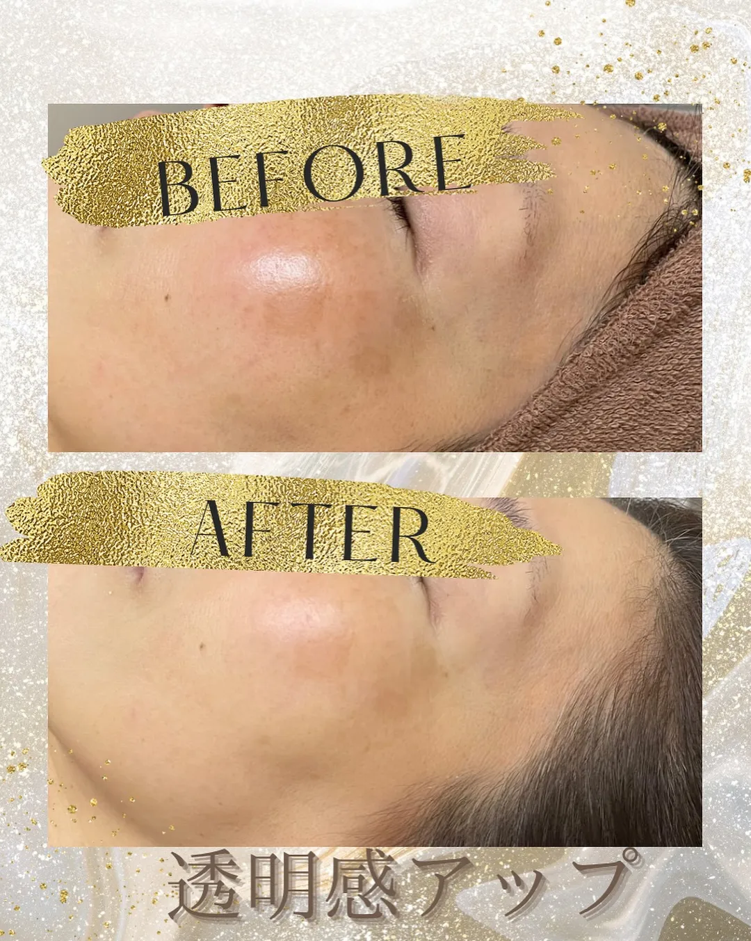 シミ、くすみ気になる方へ