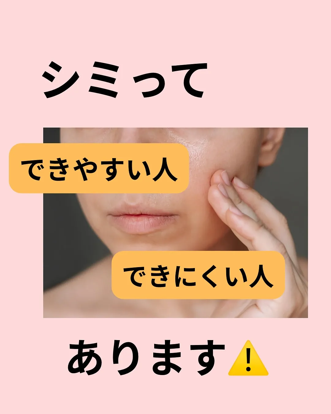 シミ濃くなった😭