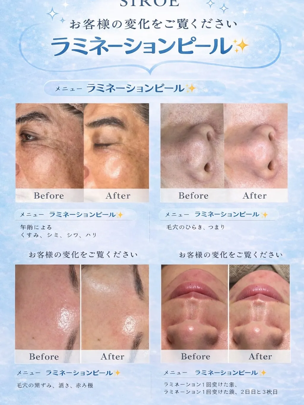 老け顔さよなら👋