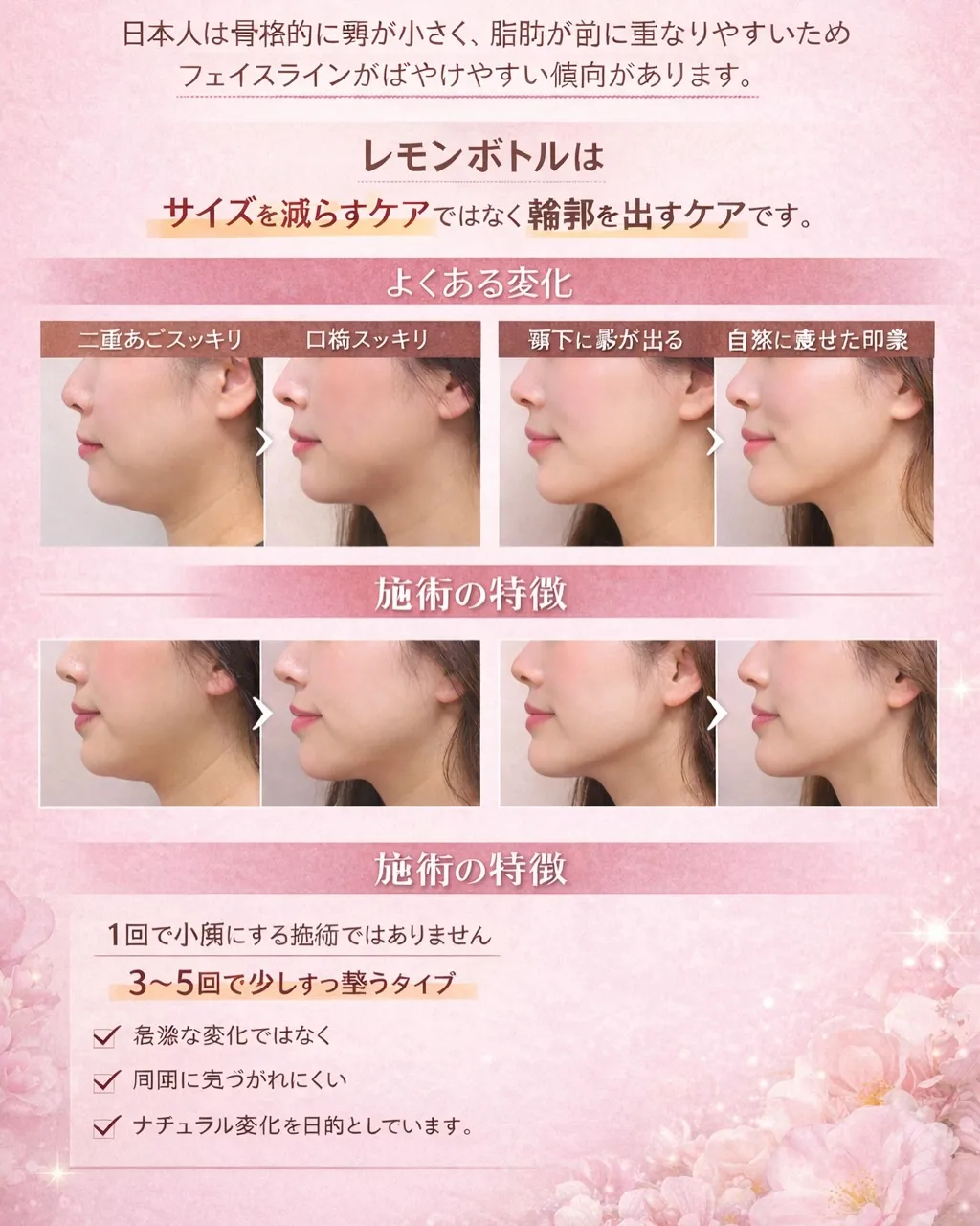 二重顎気になりませんか？