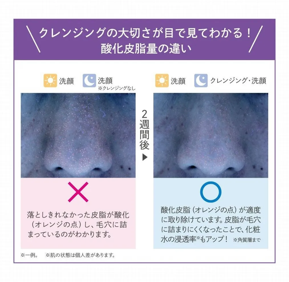 美肌になりたい!