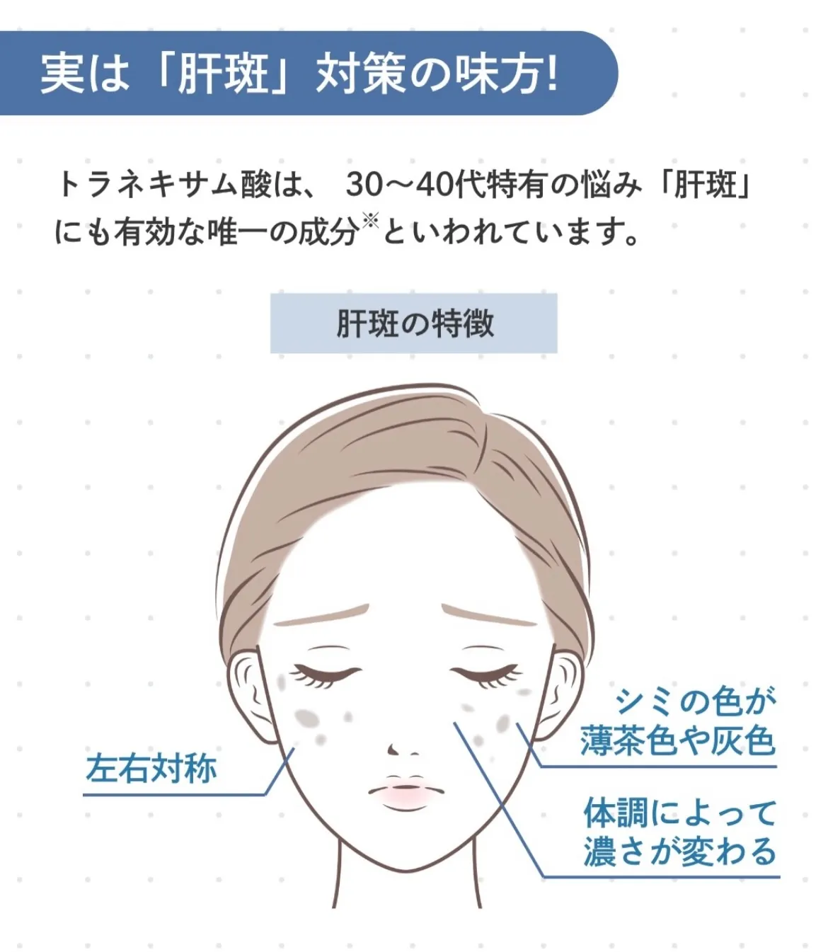 \シミ対策/