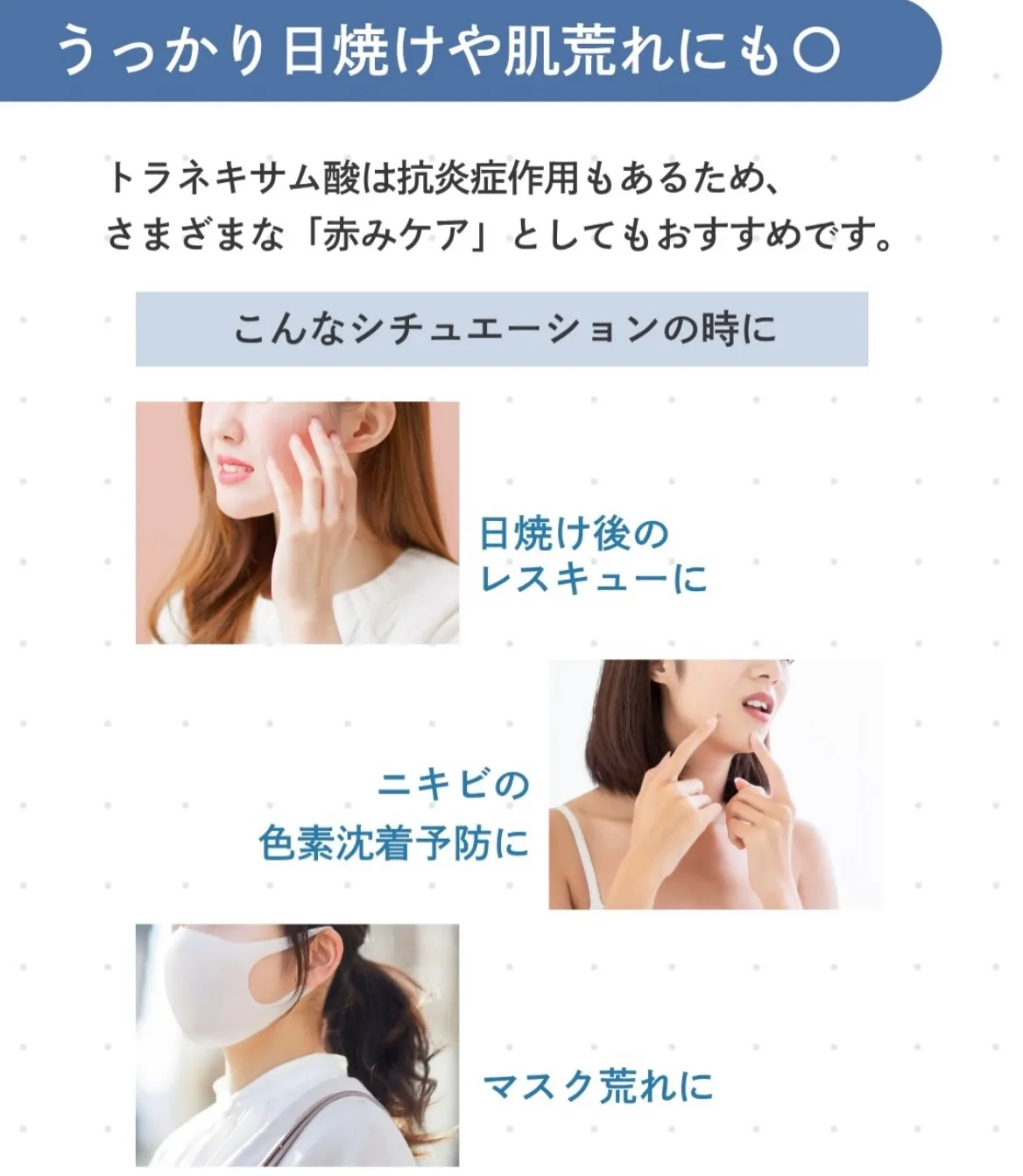 \シミ対策/
