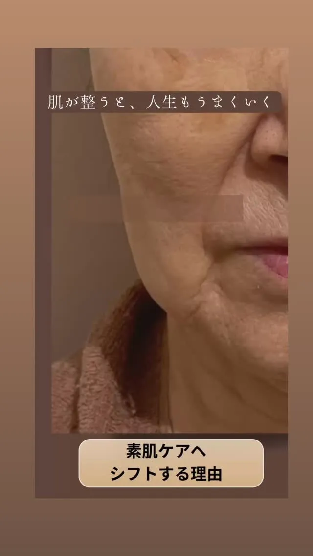 大人の毛穴開き😭